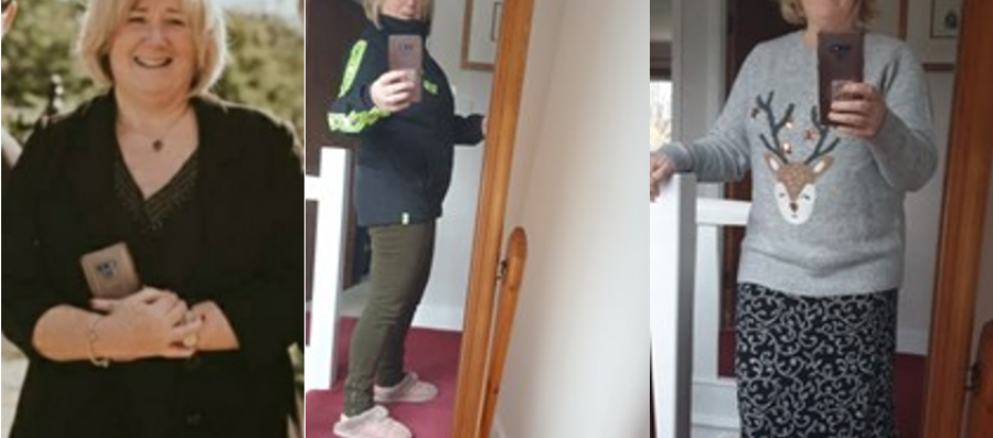 An Allurion Program patient lost weight after Allurion Balloon
