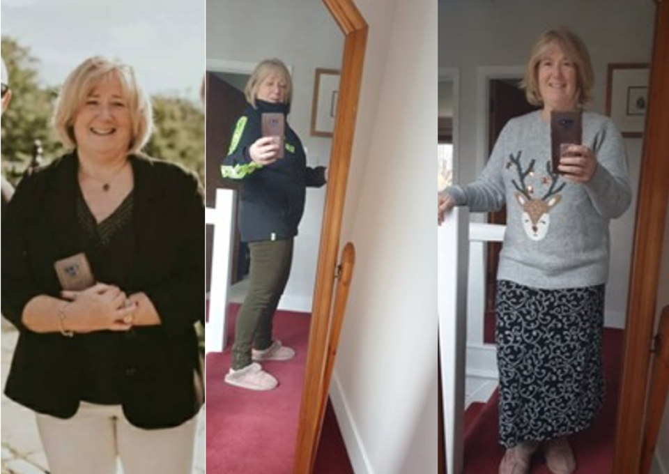 An Allurion Program patient lost weight after Allurion Balloon
